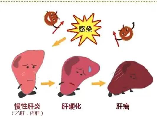 幸福宝app污无限制观看版下载厂家提醒肝脏疾病治不好？要了解是否含铁食物摄入多